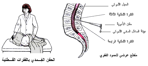 ماهو الكيماوي